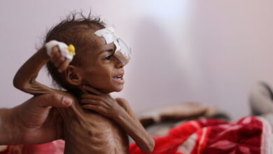 قحطی در یمن